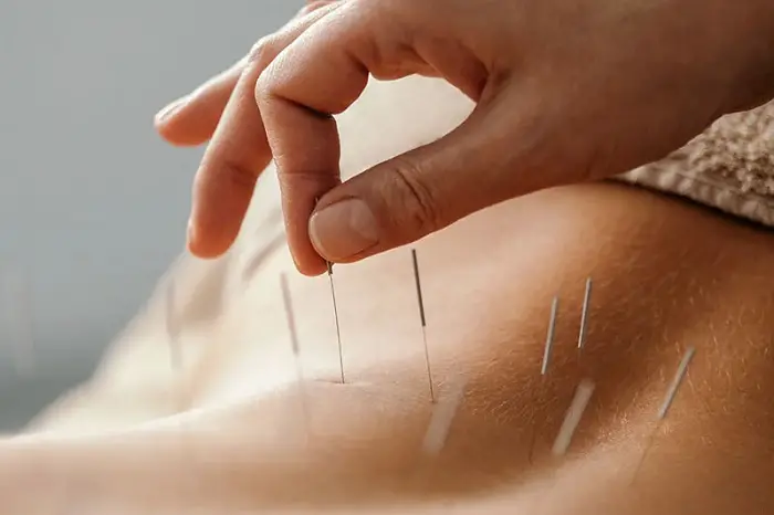 sample letters of medical necessity for acupuncture